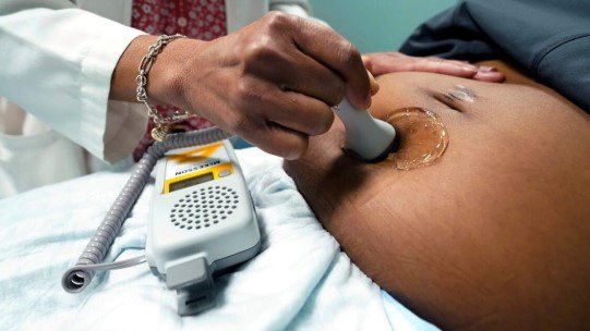 WHO launches global plan to reduce deaths from high blood pressure in pregnancy